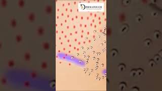 Best hair transplant center hydrodermabrasion skincareproducts dehradun uttarakhand shorts [upl. by Haag]