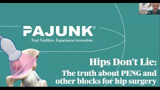 The Hips Don’t Lie The Truth about PENG amp Other Hip Blocks [upl. by Itraa]