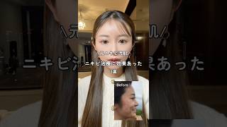 まずは原因特定！！美容整形美容整形肌管理韓国美容スキンケアコスメ垢抜け [upl. by Eidur]