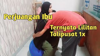 Proses Melahirkan Normal Dengan Lilitan Tali Pusat  Part 1 [upl. by Duer]