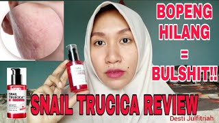 KENAPA BERHENTI PAKAI SERUM SNAIL TRUECICA  REVIEW JUJUR [upl. by Egamlat]