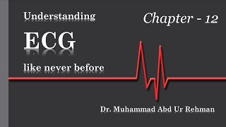 Learning ECG like Never before Ch12  SVT AVNRT OrthodromicAntidromic AVRT amp Retrograde Pwaves [upl. by Azzil296]