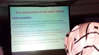 Caloric Test Procedures amp Interpretation Prof Dr Adel Abdel Maksoud 2 [upl. by Ruiz]