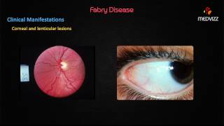 Fabrys disease [upl. by Hochman414]