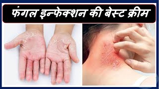 Benzocort Cream Review In Hindi  Uses Dose Side effects amp Price [upl. by Melodee889]