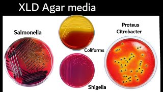 XLD agar  Xylose Lysine Deoxycholate Agar isolation of Salmonella Bacteria  Microbiology [upl. by Eillib]