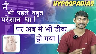 Successful Hypospadias Surgeon in Kolkata  मूत्र का छिद्र सही जगह पर न खुलने की समस्या  Dr Nagwani [upl. by Annel763]