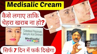 Medisalic cream Medisalic cream ke fayde  Medisalic Cream For Fairness  Safe or Not Review Hindi [upl. by Leith]