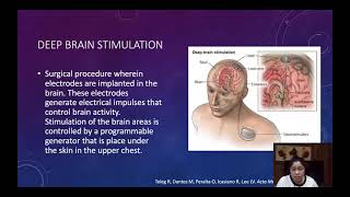 XLinked Dystonia Parkinsonism XDP Lubag Syndrome [upl. by Sherwynd]