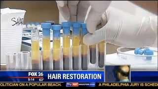 ACell  PRP Stem Cell Hair Regrowth Treatment  Houston Hair Surgeon Dr Dan McGrath [upl. by Lilia]