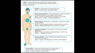 Traitements Naturel Des Mycoses [upl. by Cenac]