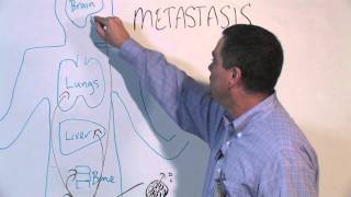 How Cancer Spreads Metastasis  Michael Henry PhD [upl. by Eamon]