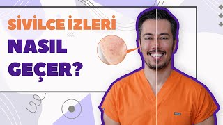 Sivilce İzleri Nasıl Geçer Akne İzleri Tedavisi [upl. by Aicilyt494]