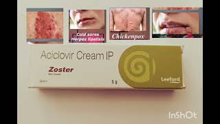 Zoster cream  Zoster cream uses side effects acyclovir cream use acyclovir cream review [upl. by Eslehc]