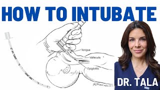 Neonatal intubation made SUPER EASY Stepbystep instructions [upl. by Rehposirhc]