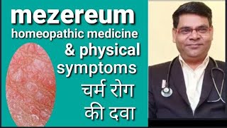 Mezereum 30  Mezereum 200  Mezereum 1m  mezereum homeopathic medicine uses in hindi [upl. by Notsnarc]