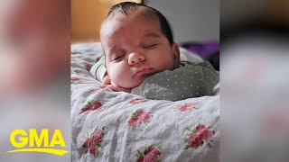 Baby girl born with rare 4pound tumor [upl. by Vinnie]