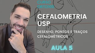 AULA 5 CEFALOMETRIA USP  Desenhos pontos traçados e análise cefalométrica USP [upl. by Jobi550]