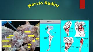 Sistema Nervioso Periférico de Equino y Canino Plexo Braquial [upl. by Marijo950]