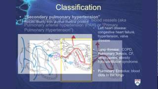 Pulmonary Hypertension A challenging cause of shortness of breath [upl. by Erait]