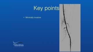 Sydney Medical Interventions  Leg Angioplasty [upl. by Oalsinatse]