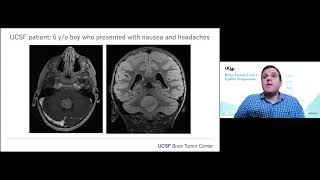 Brain Tumor GenomicsEpigenomics  David A Solomon MD PhD [upl. by Haskel]