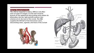 abdomen arterial angiography anatomy [upl. by Morrell]