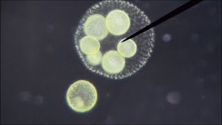 Midday DancerVolvox aureus under the microscope [upl. by Pozzy]