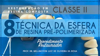 8 Técnica da Esfera de Resina PréPolimerizada [upl. by Etiuqram637]