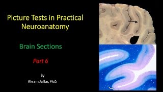 Picture Test in Neuroanatomy Brain Sections 6 [upl. by Assirialc]