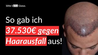 16 Jahre Haarausfall und 37000€ später Meine haarausfall und haartransplantation Geschichte [upl. by Eanerb]