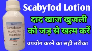 Scabyfod Lotion  Uses Side Effects  शरीर में होने वाली खुजली से पाएं छुटकारा [upl. by Dirfliw787]