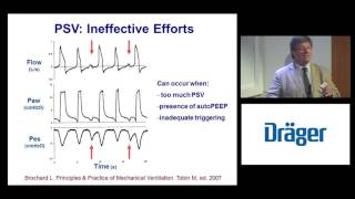 Patient Ventilator Asynchrony Lluis Blanch [upl. by Sadye468]