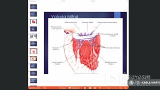 Sd valvular mitral  Estenosis e insuficiencia aortica  clase 38 y 39  sem 7 [upl. by Danny]