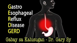 GastroEsophageal Reflux Disease GERD  Dr Gary Sy [upl. by Josiah]