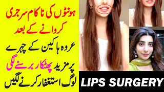 Urwa Hocane Latest Pics After Lips Surgery [upl. by Nahshu]