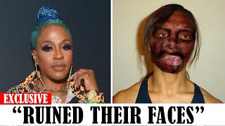 20 Black celebrities Who RUINED Their Careers With PLASTIC SURGERY [upl. by Enovahs]