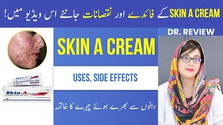 Dr Reviewed SKIN A CREAM  Uses  Side Effects  Tretinoin Cream  Beauty Facts  UrduHindi [upl. by Epperson873]