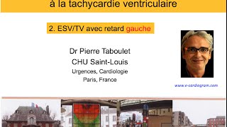 10b De lESV à la tachycardie ventriculaire Retard gauche P Taboulet [upl. by Naaitsirhc888]