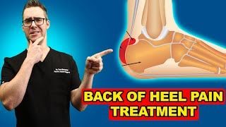 Retrocalcaneal Heel Bursitis Pain in the back of the Heel TREATMENT [upl. by Carlisle443]