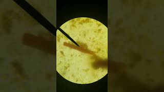 Microbiology Strongyloides stercoralis [upl. by Teillo246]