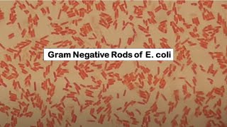 E coli in Gram staining [upl. by Norvall]