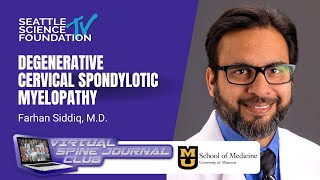 Degenerative Cervical Spondylotic Myelopathy  Farhan Siddiq MD amp Mizzou Neurosurgery [upl. by Oakley]