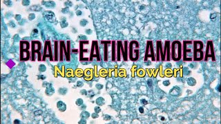 BrainEating Amoeba Naegleria fowleri [upl. by Violet]