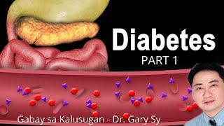 Diabetes Mellitus Part 1  Dr Gary Sy [upl. by Eelano541]