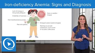 Irondeficiency Anemia Signs and Diagnosis – Pediatric Nursing  Lecturio Nursing [upl. by Willey]