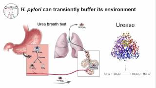 Gastritis H Pylori Persistence [upl. by Meelas]