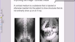 A level Medical Physics  X rays  image intensifiers and contrast media [upl. by Livvie918]