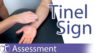 Tinel Sign Wrist  Carpal Tunnel Syndrome Diagnosis [upl. by Esli]