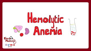 HEMOLYTIC ANEMIA Extravascular v Intravascular Clinical Features Diagnosis Coombs Test  Rhesus [upl. by Rosemaria601]